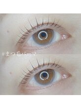 ボアップ(boappu)/マツパ