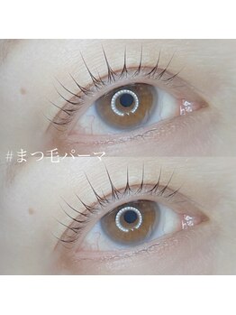 ボアップ(boappu)/マツパ