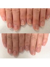 ウェルズユキ(well's yuki)/ささくれ/硬い皮膚/美爪