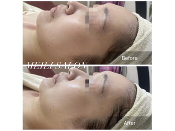 メイリー(MEILI)/