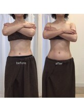 ジョワイユ(Joyeux)/腸の位置でお腹は変わる