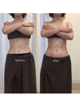 ジョワイユ(Joyeux)/腸の位置でお腹は変わる