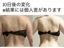 ヨサパーク ボヌール 門司駅店(YOSA PARK bonheur)/色の変化とむくみのない背中！