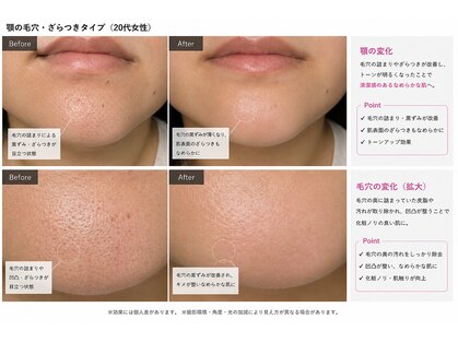 ポアラ(POARA)の写真