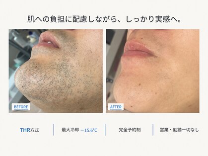 アットイカウ 下北沢(at ikaw)の写真