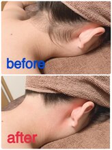 ビューティスペースグリッター(beauty space Glitter)/BeforeAfter