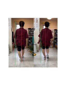 ナカザワ(NAKAZAWA)/股関節が痛い・2