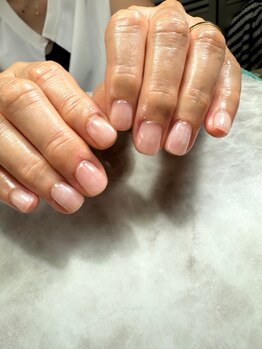 フルーヴ(Fleuve)の写真/どこに行っても改善されない長年の爪のお悩みを抱えた方は是非当店へ!どんなお悩みもお任せください