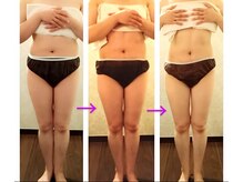 バービーホリック(barbie holic)/痩身　途中経過の変化　４０代