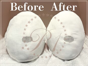 R-1ビューティーサロン 表参道/Before &After(12回)