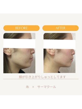 ムーンライズ(moonrise)/