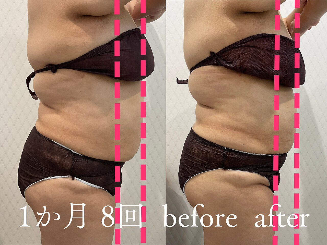 新生活応援CP◆寝てるだけ3万回筋トレ！脂肪燃焼＆引き締め痩身\10450→\3300