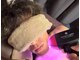 エステサロン オパール(OPALE)の写真/脱毛から卒業!【宮崎市初導入★最新脱毛"プラチナビーム脱毛"】《最短でお得に!目に見える脱毛効果を実感》