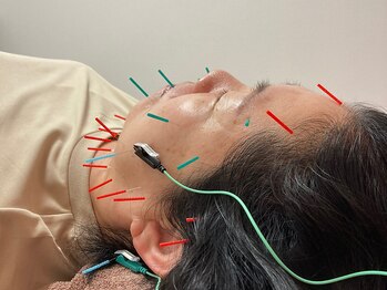 ばば鍼灸院/50代女性の方