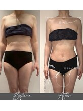 インフィニーズ(INFINEEZ)/カスタマイズ90分美容整体40代