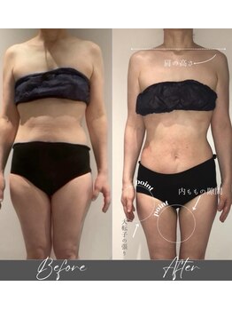 インフィニーズ(INFINEEZ)/カスタマイズ90分美容整体40代