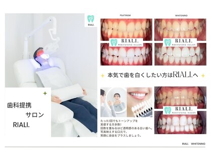 リアリ 宮崎(RIALI.)の写真