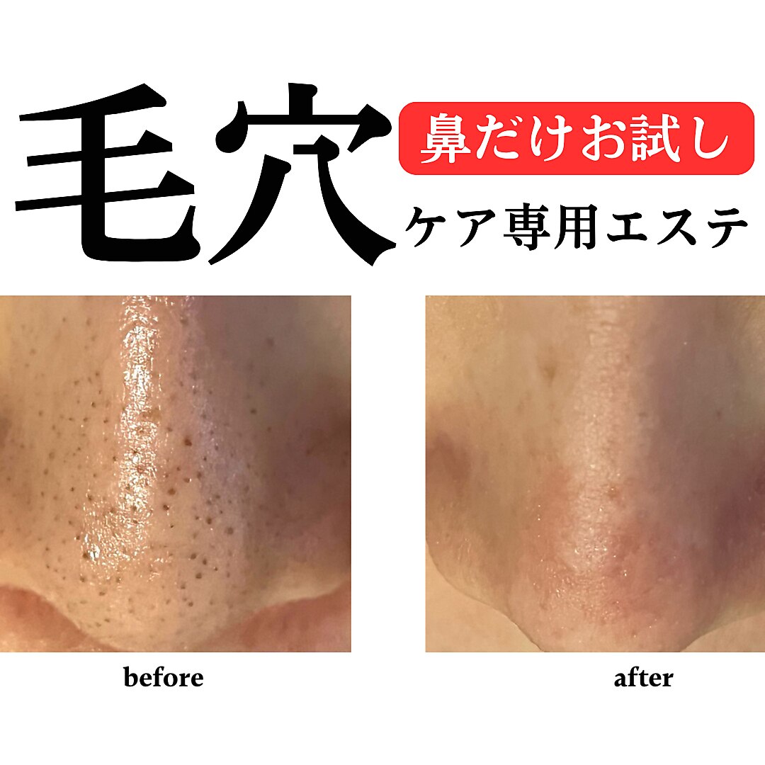 美容液 bluemoon R 工藤静香プロデュースのオーガニックブランド「アマネ バイ