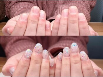 クウ(KUU)の写真/深爪矯正に特化したメニューでずっと悩んだ深爪から卒業◎丁寧な付け替え技術、ネイルケアでお悩み解消へ◇