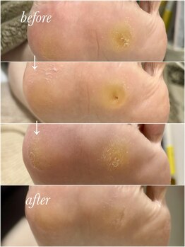 リゼラアンドコー 布施店/