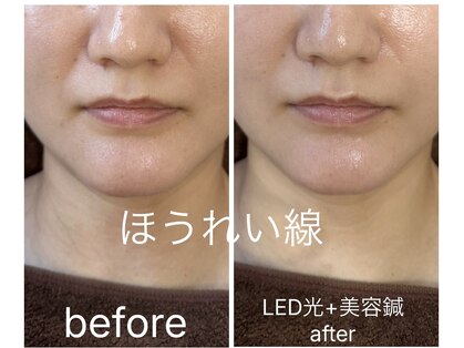 エミ(emi)の写真