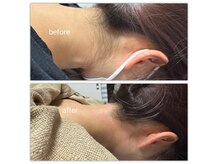 【光脱毛/WAX脱毛】doucek beautyの雰囲気(うなじ綺麗!!)