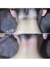 ピークハント(Peak Hunt)/うなじ脱毛