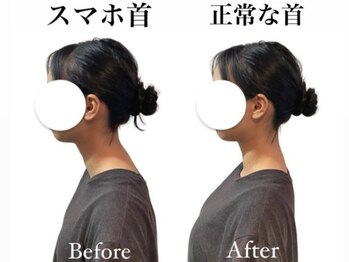 ハリカ 東京新宿店(HARIKA)/スマホ首/肩こりにはコレ！