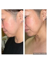 ビユ 大泉店(BIYU)/