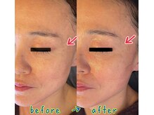 クレール(Claire)/シワ改善で若々しい肌へ♪