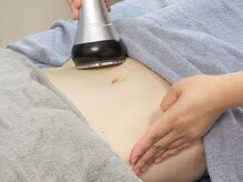 ヴィコロン(Vicolone)/キャビテーション