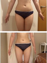 パルティール 恵比寿店(partir)/お腹スッキリ＆太ももに隙間！