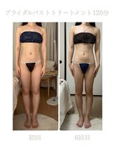 ハリムーン 仙台(harimoon)/バスト・ブライダル