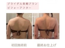 ティアラ(Tiara)の雰囲気(【ブライダル】どこから見ても美しい花嫁姿へ)