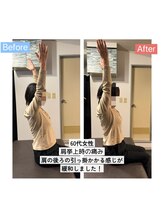 アンティオール 大森本店/Before→After【肩のお悩み】
