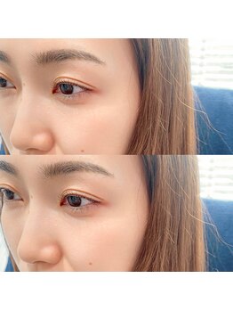 ムルチュラ 亀有店(muruchura KAMEARI)の写真/今まで抱えていたお悩み、改善してみませんか？《口コミ高評価/技術・接客力◎》