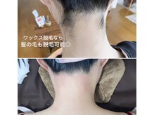 ピークハント(Peak Hunt)/うなじワックス脱毛