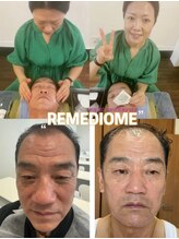 ホームサロンルビー(Home Salon Ruby)/ルンメディオダイヤモンド