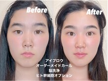 ミベレ 八王子(Mebere)/自分へのご褒美(ご褒美セット)