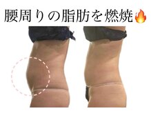 痩身革命 大宮店/ダイエットリンパマッサージ