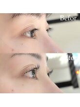 エメ 市川 本八幡(aimer)/まつ毛パーマ/ラッシュリフト