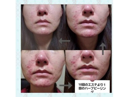 サロンド ベレーゼの写真