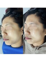 トゥインクル(Twinkle)/キュッと引き締め立体感UP！