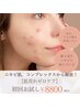【肌トラブル徹底ケア】1回で実感！肌荒れ・凸凹改善“肌荒れゼロケア”