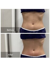 ダリア(Dahlia)/くびれ作りお任せください