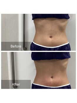 ダリア(Dahlia)/くびれ作りお任せください