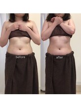 ジョワイユ(Joyeux)/腸の位置でお腹は変わる