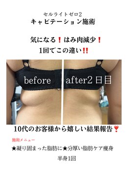 プリヴィエレジェ(privilegie)/