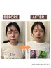 【顔の歪み|エラ張り|顔のむくみ】小顔歪み美容整体