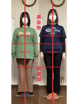 たか施術院/セルフケレッスン日常が練習場所